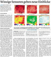 Mittelbayerische Zeitung 2011-03 - Prof. Dr. Philipp Babilas - HAUTZENTRUM REGENSBURG